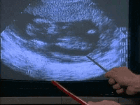 bernard nathanson 02