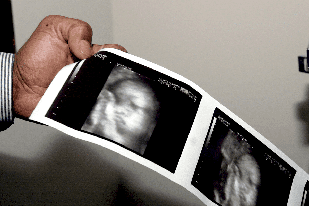 bernard nathanson 02