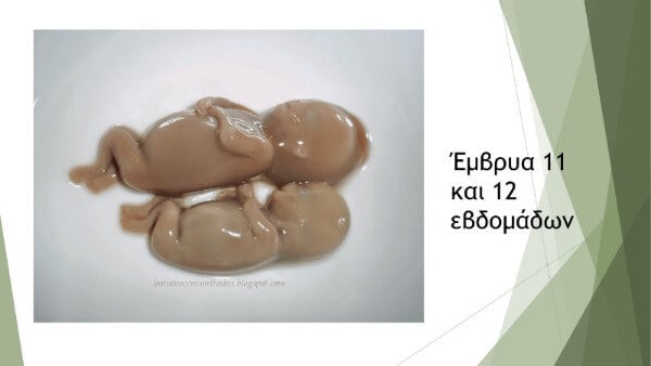 hmerida larisa siasoy paroysiash 11