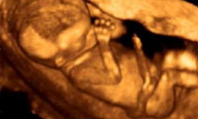 ultrasound 3 D fetus baby 01